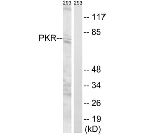 Western Blot - Anti-PKR Antibody (B8174) - Antibodies.com