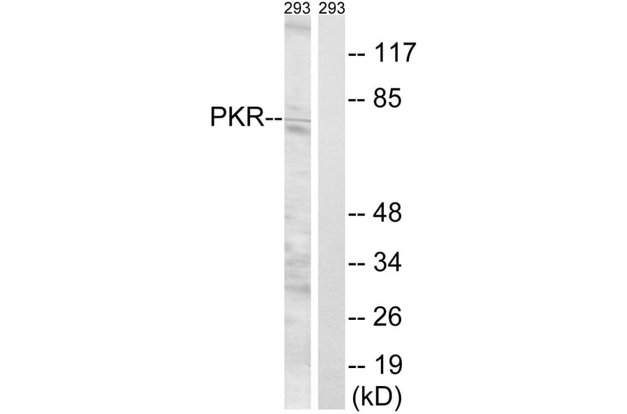 Western Blot - Anti-PKR Antibody (B8174) - Antibodies.com
