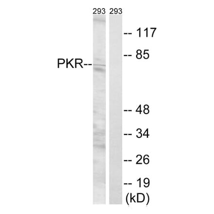 Western Blot - Anti-PKR Antibody (B8174) - Antibodies.com