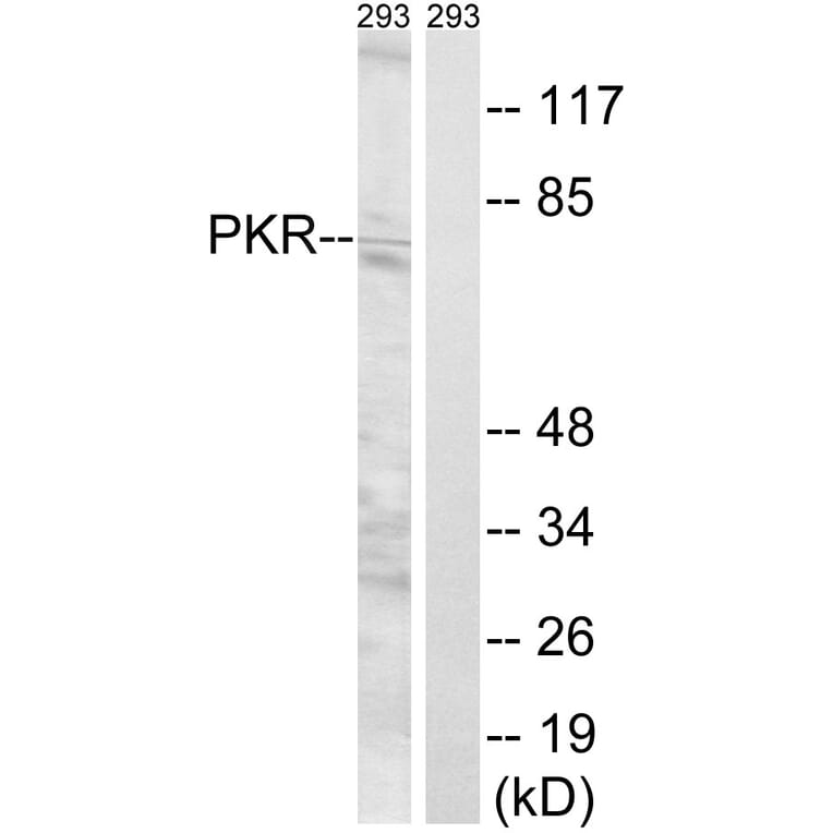 Western Blot - Anti-PKR Antibody (B8174) - Antibodies.com
