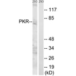 Western Blot - Anti-PKR Antibody (B8174) - Antibodies.com