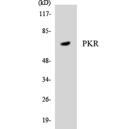 Western Blot - Anti-PKR Antibody (R12-3332) - Antibodies.com