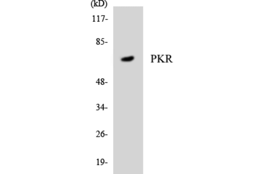 Western Blot - Anti-PKR Antibody (R12-3332) - Antibodies.com