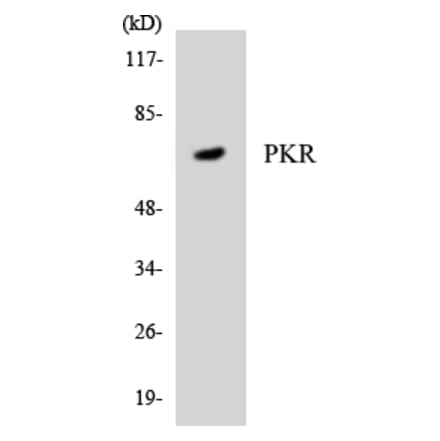 Western Blot - Anti-PKR Antibody (R12-3332) - Antibodies.com