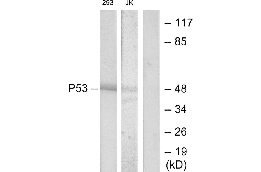 Western Blot - Anti-p53 Antibody (B7182) - Antibodies.com