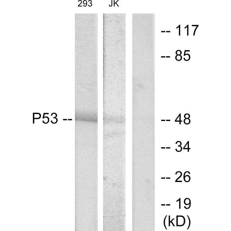 Western Blot - Anti-p53 Antibody (B7182) - Antibodies.com