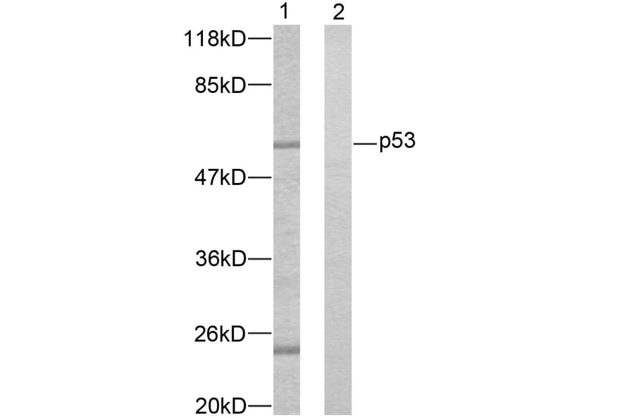 Western Blot - Anti-p53 Antibody (B7183) - Antibodies.com