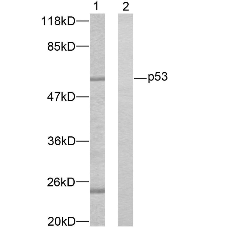 Western Blot - Anti-p53 Antibody (B7183) - Antibodies.com