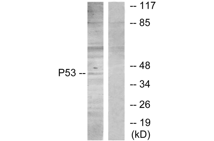 Western Blot - Anti-p53 Antibody (B7181) - Antibodies.com