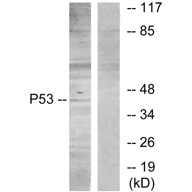 Western Blot - Anti-p53 Antibody (B7181) - Antibodies.com