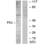 Western Blot - Anti-p53 Antibody (B7181) - Antibodies.com