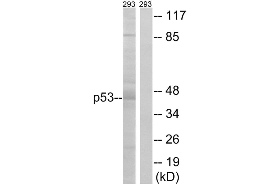 Western Blot - Anti-p53 Antibody (B7184) - Antibodies.com