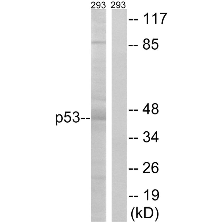 Western Blot - Anti-p53 Antibody (B7184) - Antibodies.com