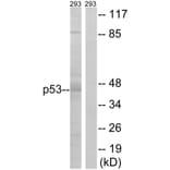 Western Blot - Anti-p53 Antibody (B7184) - Antibodies.com