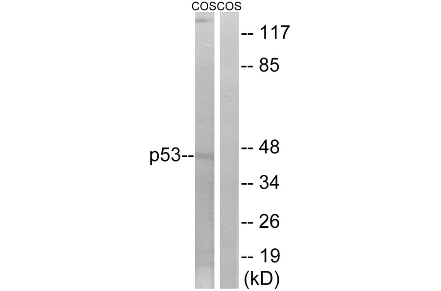 Western Blot - Anti-p53 Antibody (B7186) - Antibodies.com
