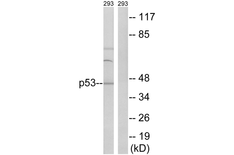 Western Blot - Anti-p53 Antibody (B8051) - Antibodies.com