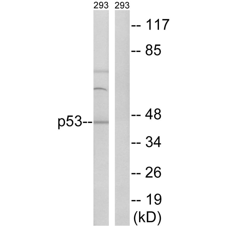 Western Blot - Anti-p53 Antibody (B8051) - Antibodies.com