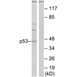 Western Blot - Anti-p53 Antibody (B8051) - Antibodies.com