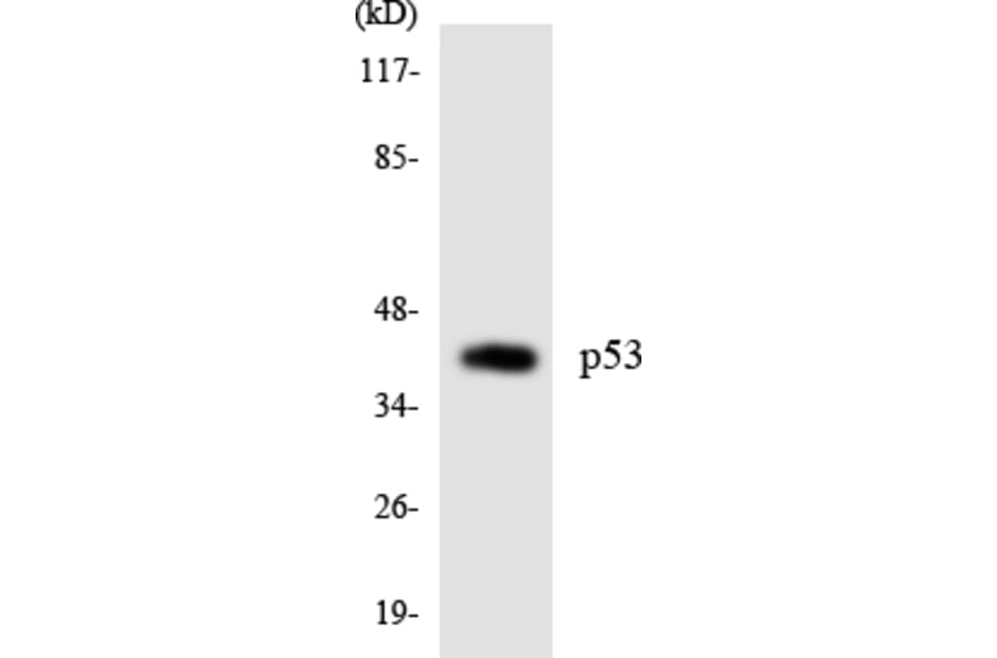 Western Blot - Anti-p53 Antibody (R12-3287) - Antibodies.com