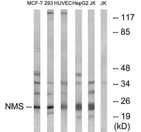 Western Blot - Anti-NMS Antibody (C16974) - Antibodies.com
