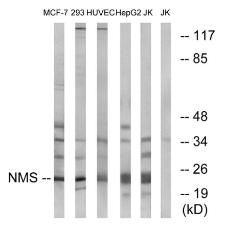 Western Blot - Anti-NMS Antibody (C16974) - Antibodies.com