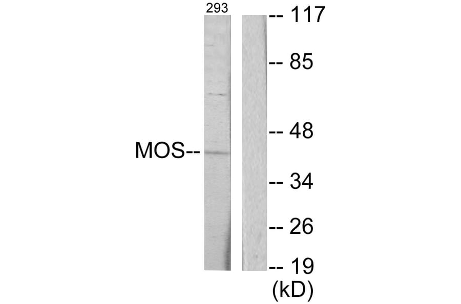 Western Blot - Anti-MOS Antibody (C10258) - Antibodies.com