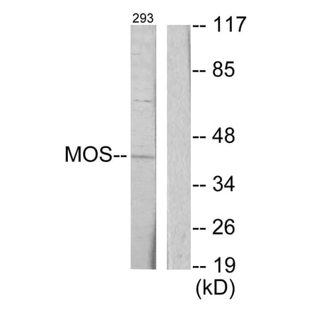 Western Blot - Anti-MOS Antibody (C10258) - Antibodies.com