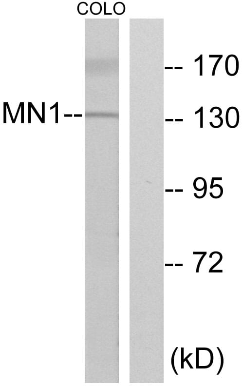 Western blot analysis of lysates from COLO cells using Anti-MN1 Antibody. The right hand lane represents a negative control, where the antibody is blocked by the immunising peptide.