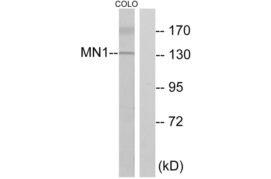Western Blot - Anti-MN1 Antibody (C10914) - Antibodies.com