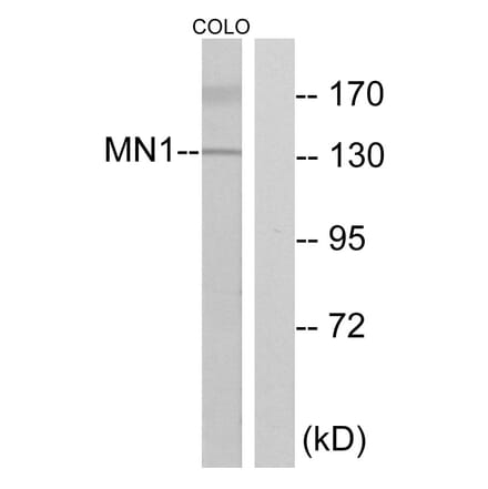 Western Blot - Anti-MN1 Antibody (C10914) - Antibodies.com