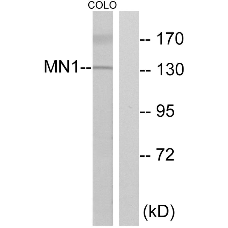 Western Blot - Anti-MN1 Antibody (C10914) - Antibodies.com