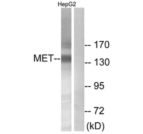 Western Blot - Anti-Met Antibody (B7151) - Antibodies.com