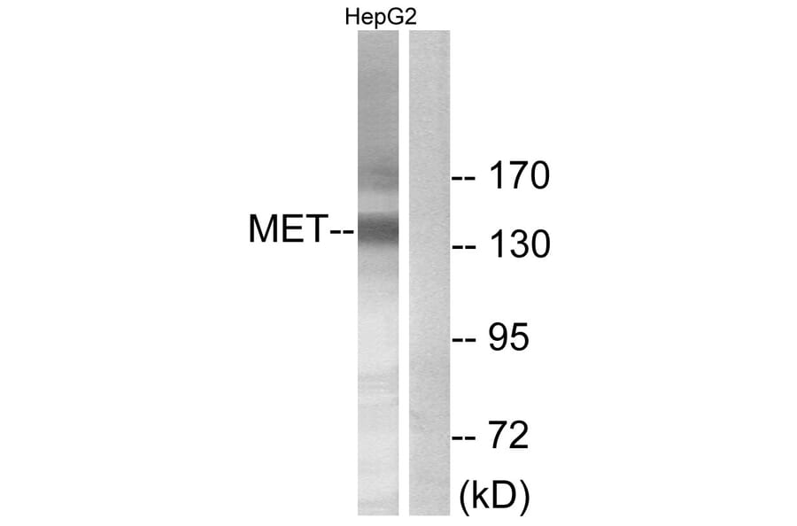 Western Blot - Anti-Met Antibody (B7151) - Antibodies.com