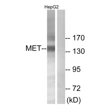 Western Blot - Anti-Met Antibody (B7151) - Antibodies.com