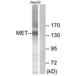 Western Blot - Anti-Met Antibody (B7151) - Antibodies.com