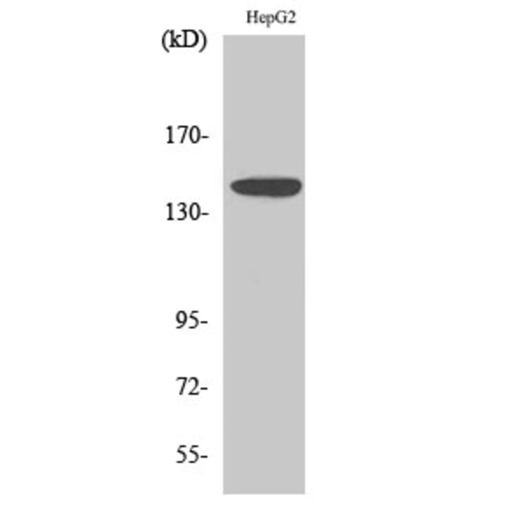 Western Blot - Anti-Met Antibody (B7151) - Antibodies.com