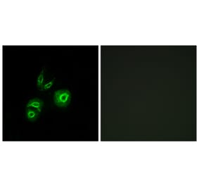 Immunofluorescence - Anti-MET Antibody (C10305) - Antibodies.com