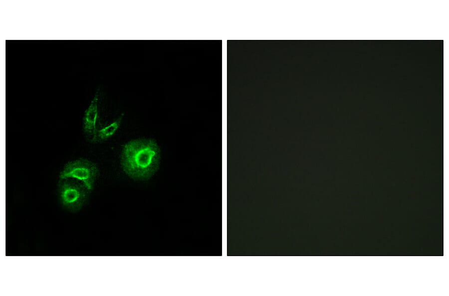 Immunofluorescence - Anti-MET Antibody (C10305) - Antibodies.com