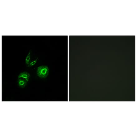 Immunofluorescence - Anti-MET Antibody (C10305) - Antibodies.com