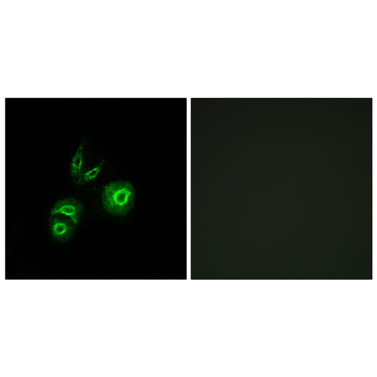 Immunofluorescence - Anti-MET Antibody (C10305) - Antibodies.com