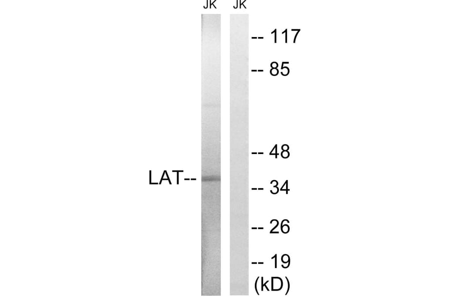 Western Blot - Anti-LAT Antibody (B8208) - Antibodies.com