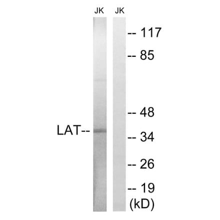 Western Blot - Anti-LAT Antibody (B8208) - Antibodies.com
