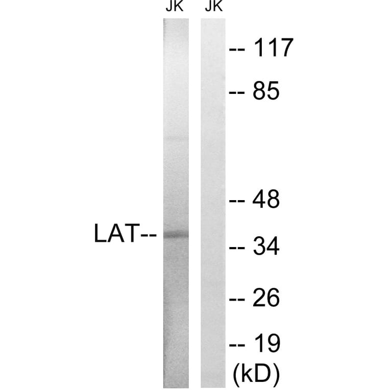 Western Blot - Anti-LAT Antibody (B8208) - Antibodies.com