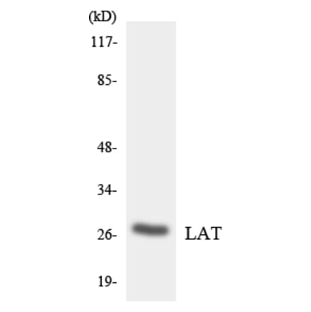 Western Blot - Anti-LAT Antibody (R12-2962) - Antibodies.com