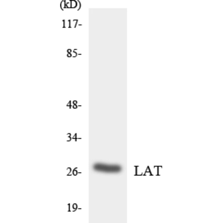Western Blot - Anti-LAT Antibody (R12-2962) - Antibodies.com