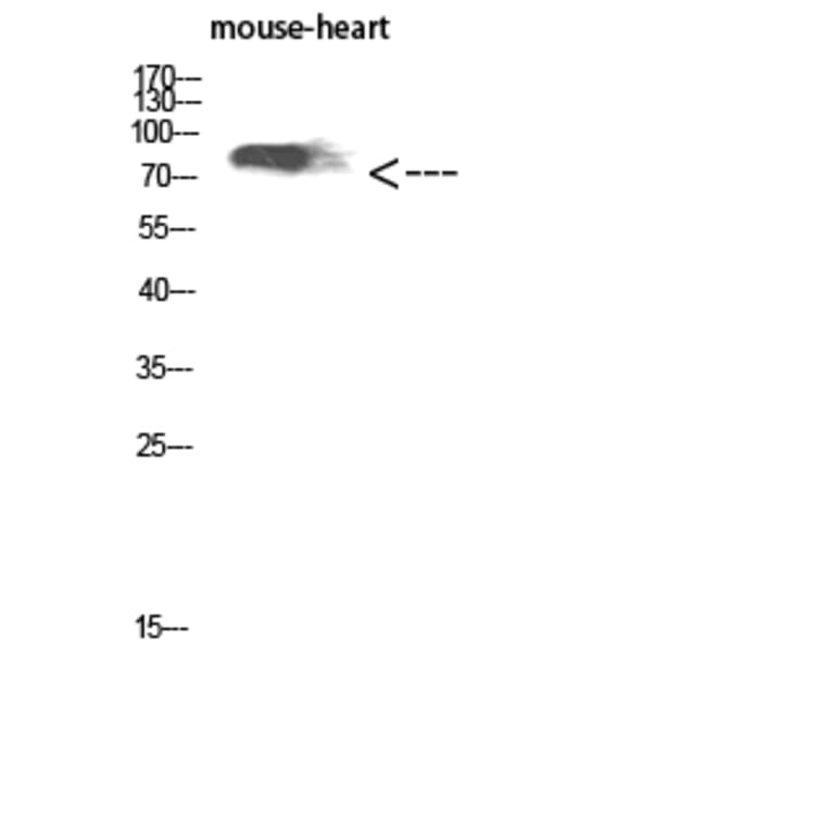 Western Blot - Anti-KEL Antibody (C30538) - Antibodies.com