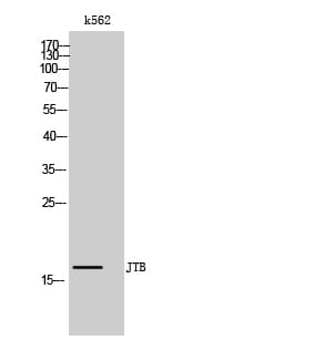 Western blot analysis of k562 cells using Anti-JTB Antibody.