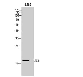 Western Blot - Anti-JTB Antibody (C17993) - Antibodies.com