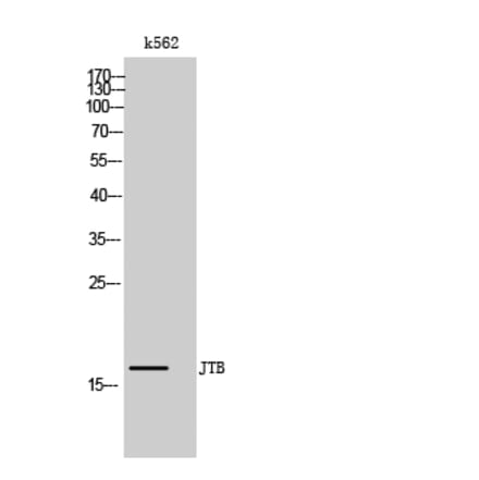 Western Blot - Anti-JTB Antibody (C17993) - Antibodies.com