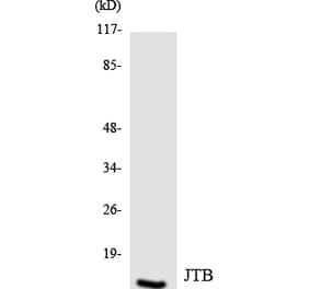 Western Blot - Anti-JTB Antibody (R12-2942) - Antibodies.com